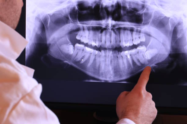 Best Emergency Dental Extractions in Trappe, MD